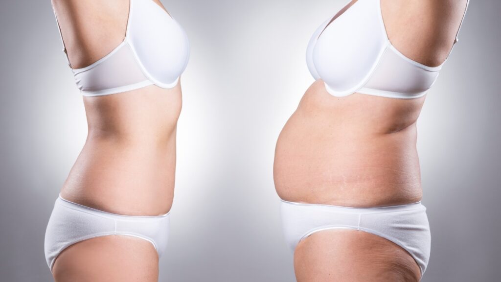 ビフォーアフター